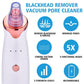 Blackhead Suction Tool for Clear Skin